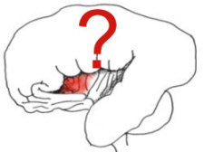 insula cortex with red question mark